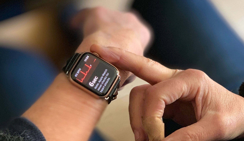 Функция получения ЭКГ в часах Apple Watch спасла человеку жизнь спустя несколько часов после выхода