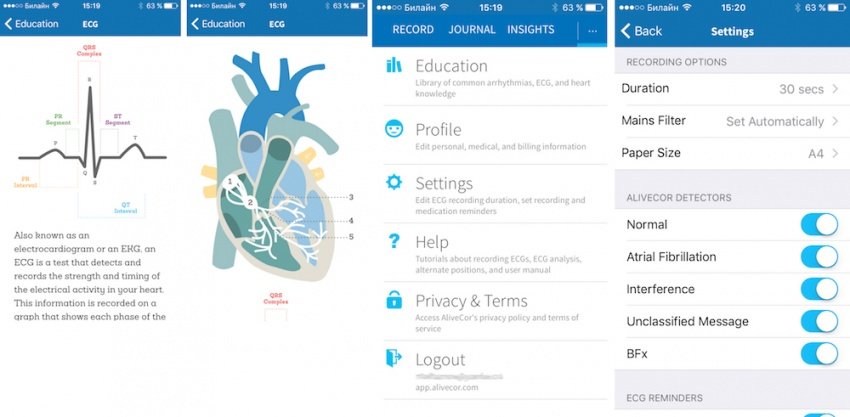 Экг Сердца Программа Скачать Экг Сердца Программа Скачать