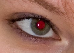 Почему Глаза Красные На Фото Со Вспышкой