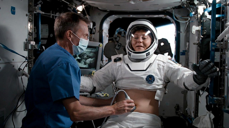 Как работает ЖКТ в космосе: результаты уникального медицинского эксперимента на МКС Как работает ЖКТ в космосе: результаты уникального медицинского эксперимента на МКС