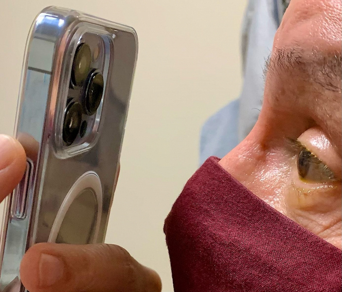 Офтальмолог уже использует макро-режим iPhone 13 Pro в своей работе