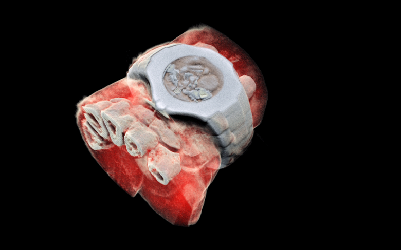 Технологии CERN позволили получить первый трехмерный цветной рентгеновский снимок человека