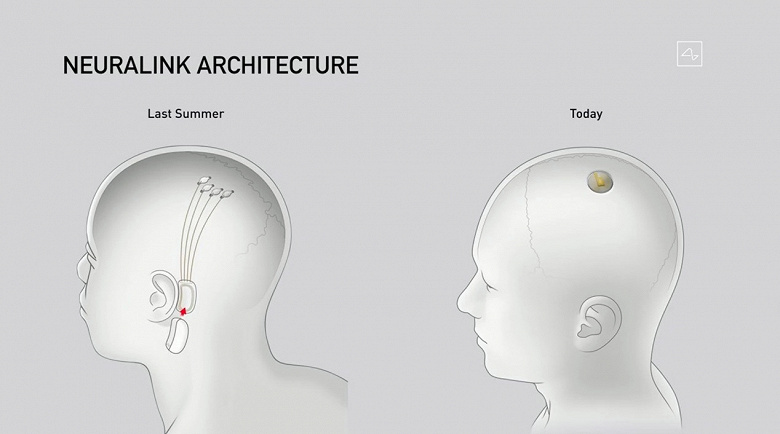 Илон Маск представил усовершенствованный интерфейс мозг-компьютер — Neuralink V2