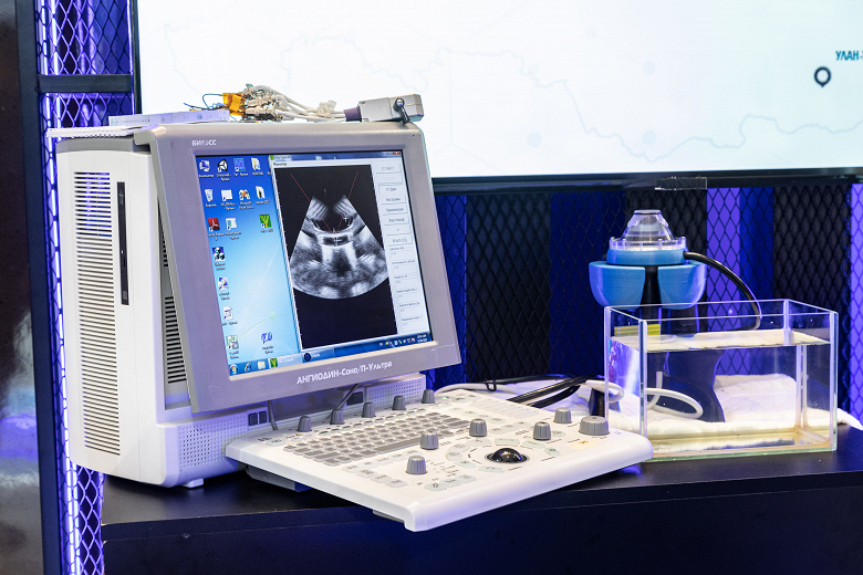 Rostec präsentierte die neuesten Geräte für die Diagnose und Behandlung von Krebs