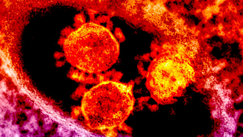 Человечество может столкнуться с новым смертельным вирусом, похожим на ВИЧ
