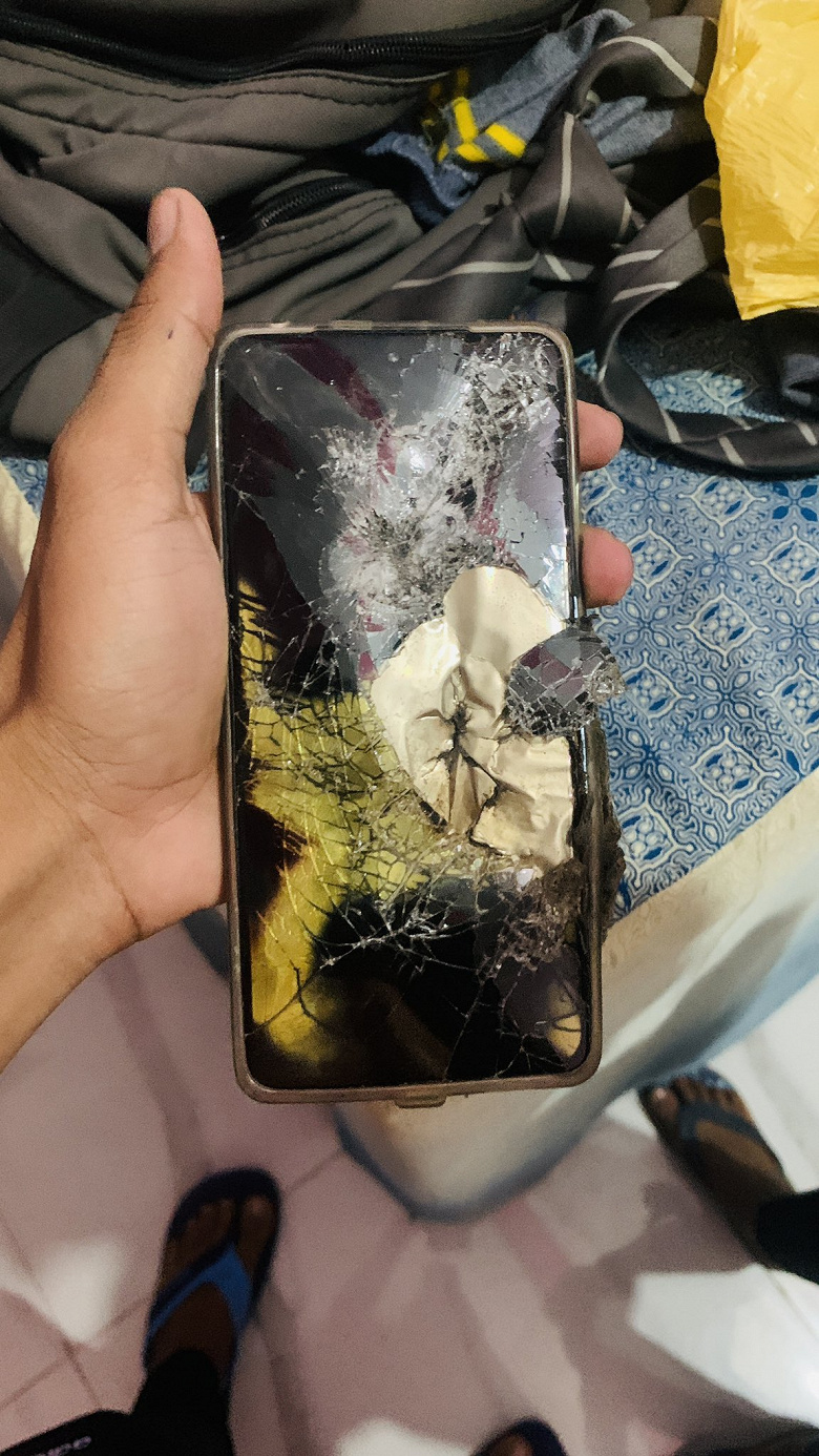 The brand new Redmi Note 12 Pro caught fire in the user's breast pocket