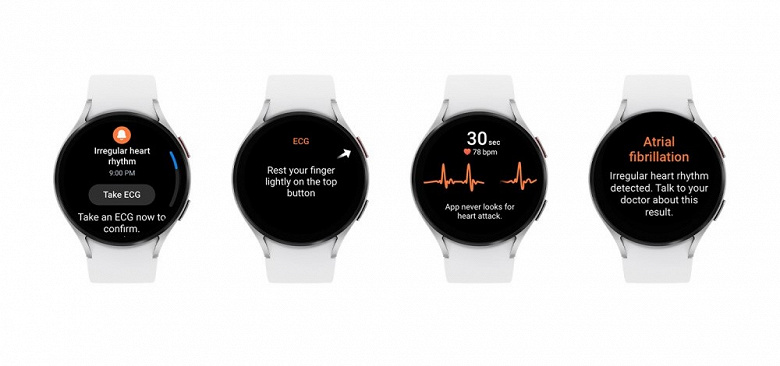 Умные часы Samsung получат функцию определения нерегулярности сердечного ритма, одобренную FDA