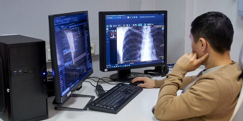 В поликлиниках Москвы внедрят анализ рентгеновских снимков без участия врача - уже с мая