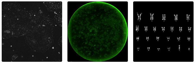 OpenAI и Retro Bio создали ИИ для белковой инженерии: новые белки ускоряют перепрограммирование клеток